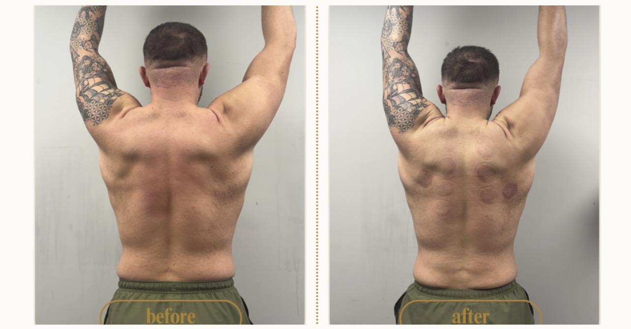 Client upper-body composition progress shown from the back