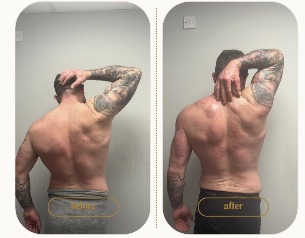Client shoulder movement comparison before and after treatment